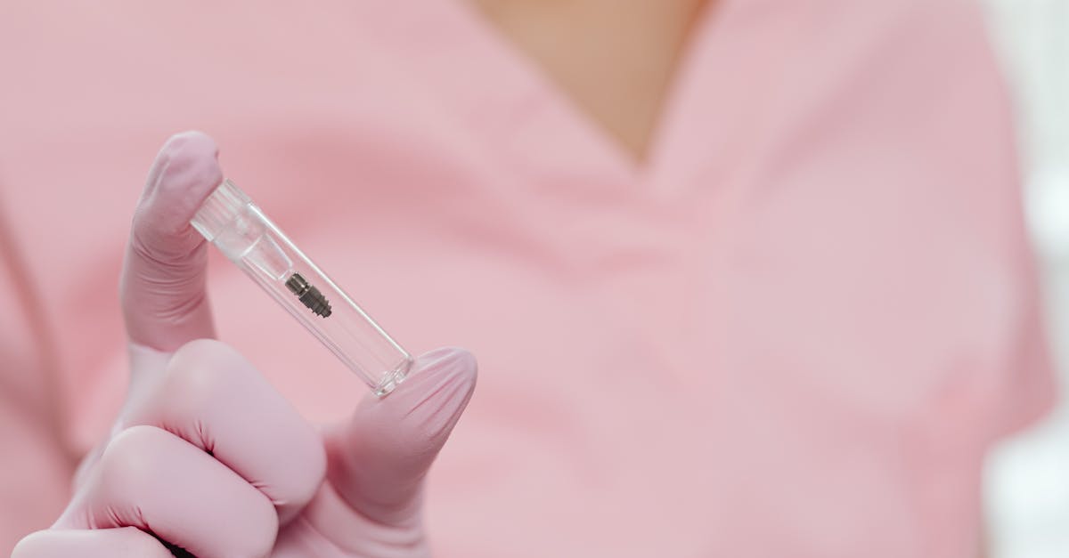 découvrez tout ce qu'il faut savoir sur l'implant dentaire : définition, avantages, déroulement de la pose et conseils pour une bonne santé bucco-dentaire. solutions modernes et durables pour remplacer une dent manquante.