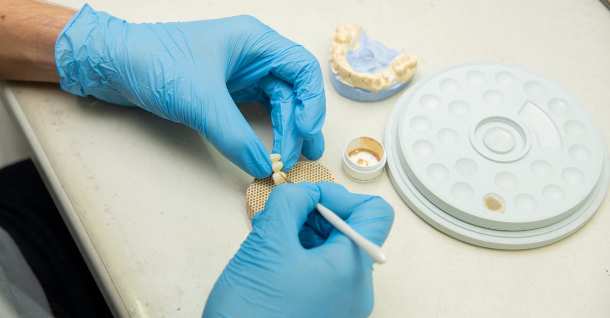 découvrez le coût des implants dentaires, les facteurs qui influencent le prix et les solutions de financement pour retrouver un sourire éclatant en toute sérénité.