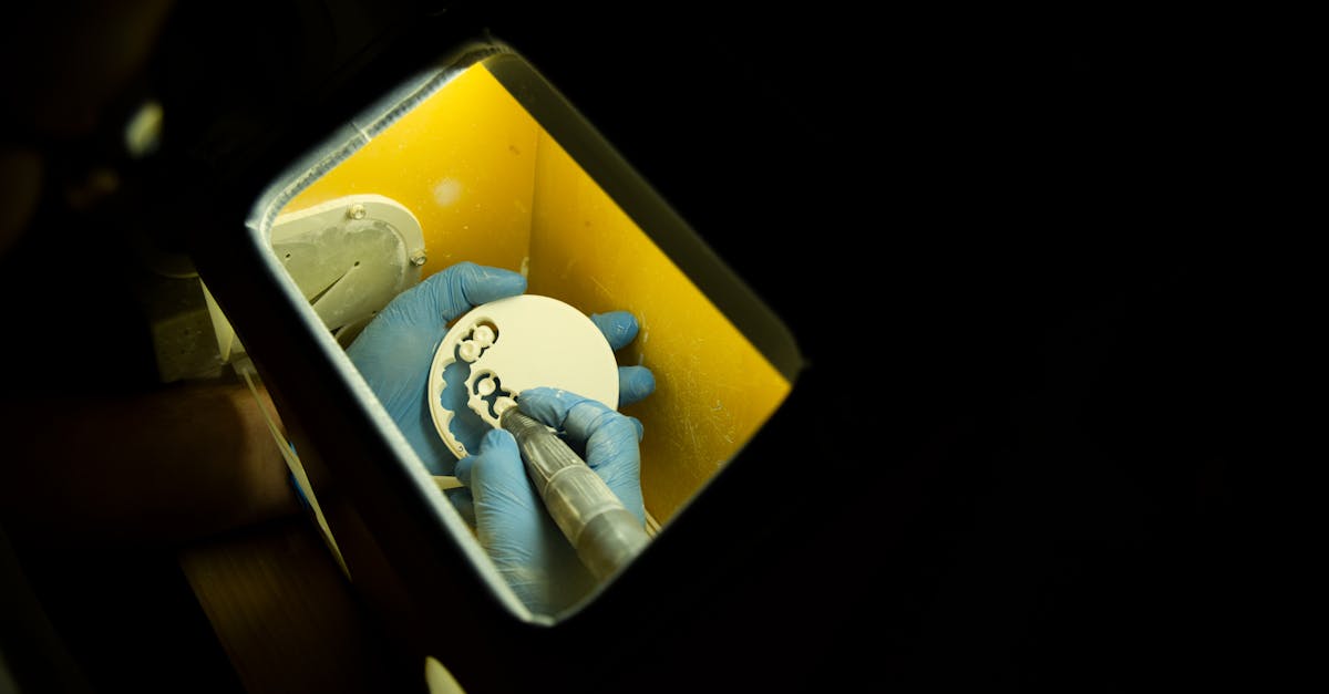 découvrez le coût des implants dentaires en france : tarifs moyens, facteurs influençant le prix, remboursement et conseils pour bien choisir votre implant dentaire.