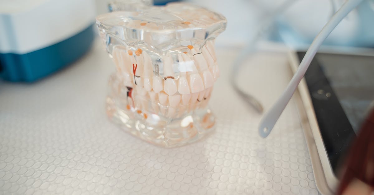 découvrez tout ce qu'il faut savoir sur le remboursement des implants dentaires : conditions, prise en charge par la sécurité sociale et les mutuelles, démarches et conseils pour optimiser votre remboursement.