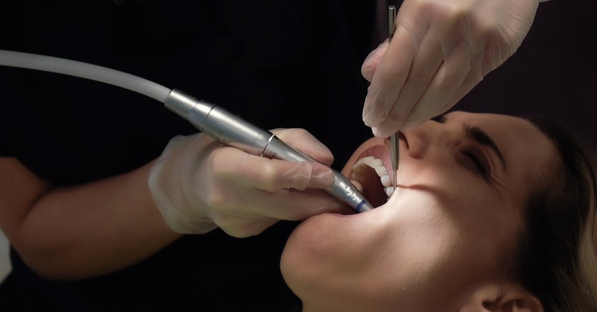 découvrez tout ce qu'il faut savoir sur l'assurance dentaire : ses avantages, les types de couvertures disponibles, et des conseils pour bien choisir votre assurance afin de préserver votre santé bucco-dentaire au meilleur prix.
