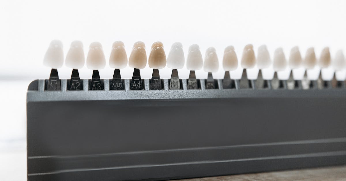 découvrez le coût du blanchiment des dents : prix moyens, facteurs influençant le tarif et conseils pour choisir la meilleure option de blanchiment dentaire en toute sécurité.