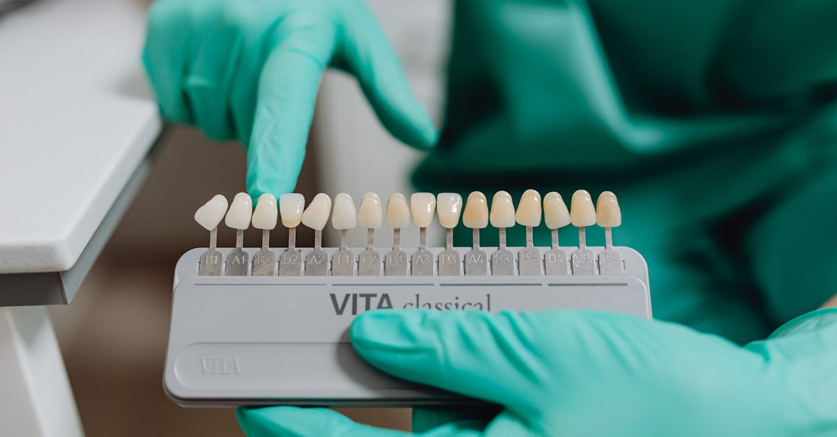découvrez les bandes blanchissantes pour les dents : une solution rapide et efficace pour un sourire éclatant à la maison. résultats visibles dès la première utilisation !